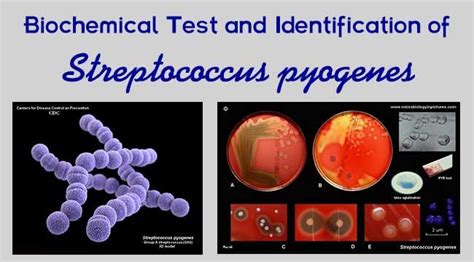 streptococcus pyogenes biochemical tests|Streptococcus Pyogenes (GAS): Characteristics, .